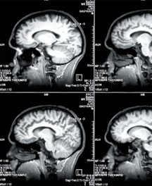Den købende hjerne – hvad kan hjerneforskningen bringe?